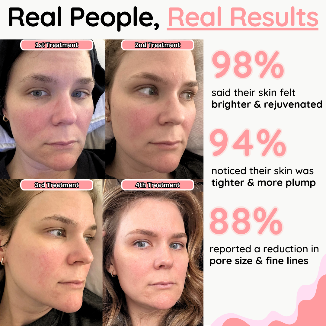 UltimaGlow Collagen Mask