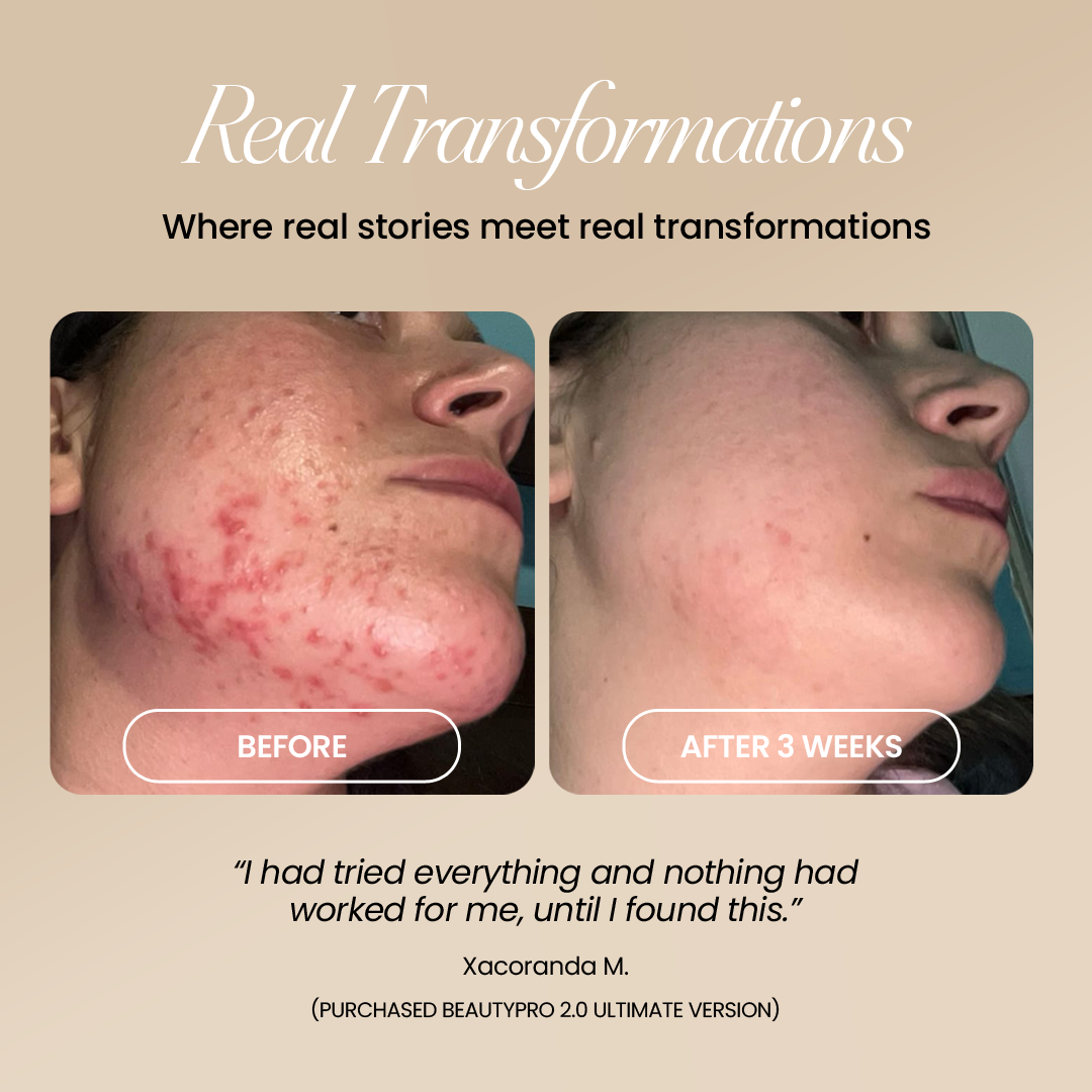 BeautyPro 2.0 - High Frequency Wand