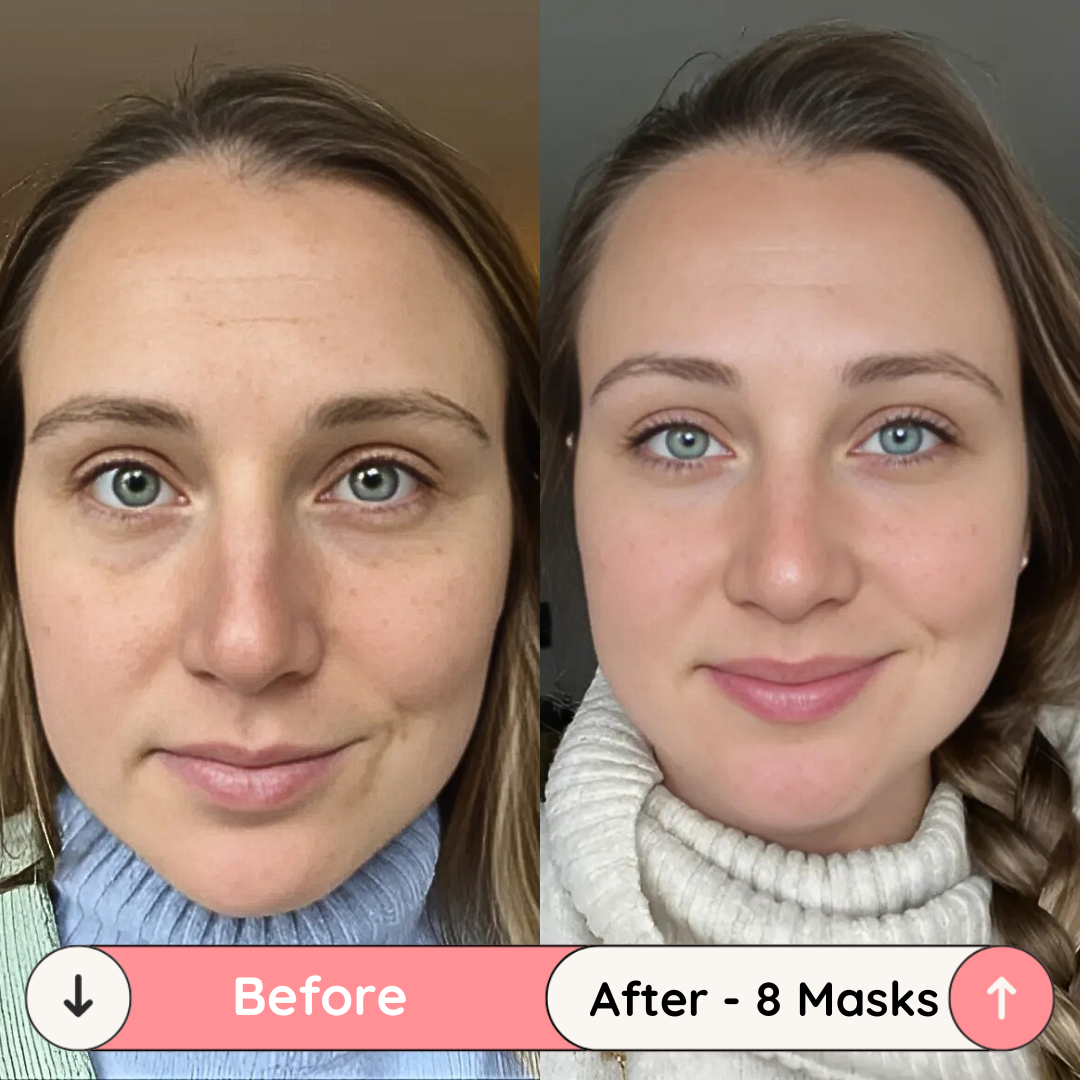 UltimaGlow Collagen Mask (5 pack)