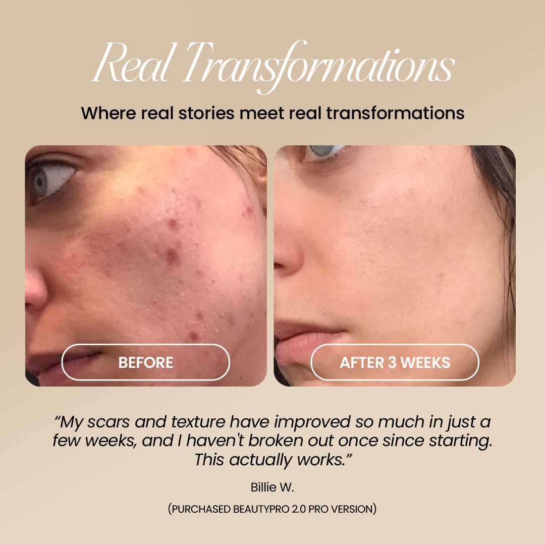 BeautyPro 2.0 - High Frequency Wand